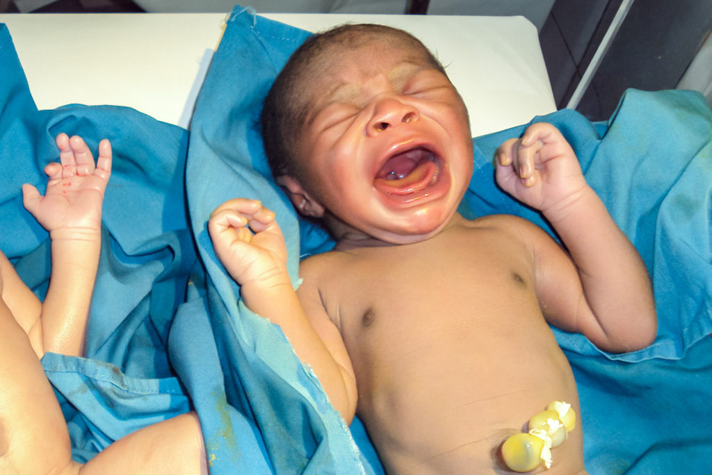 Schreiendes Baby nach der Geburt