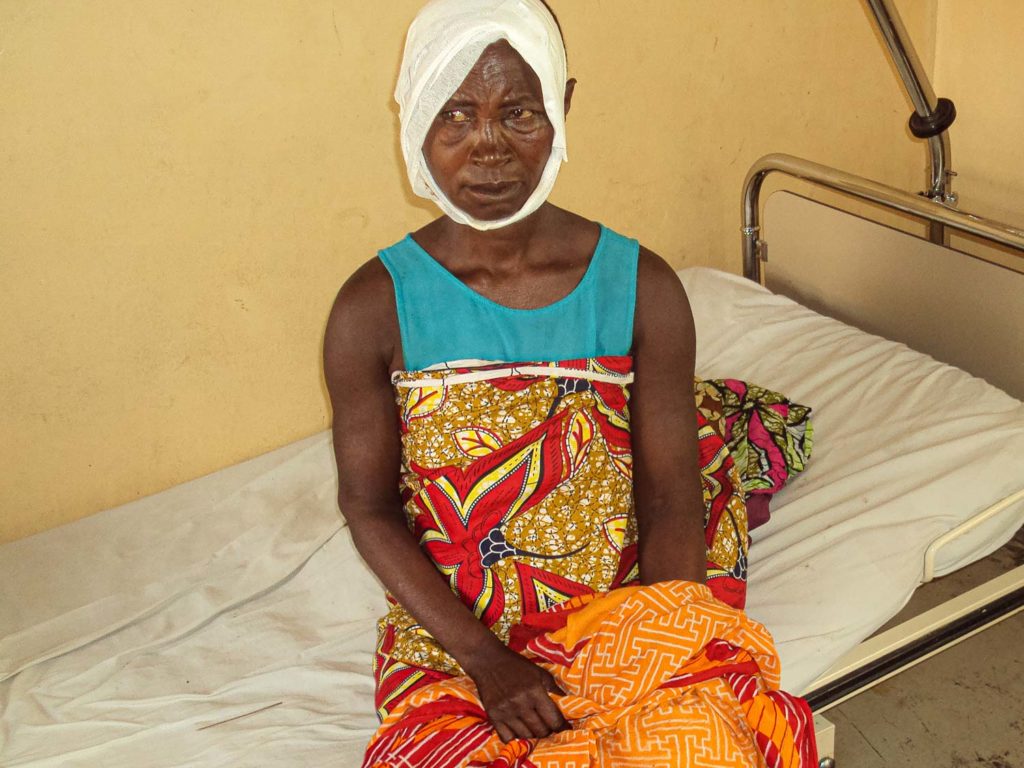 Frau Opfer eines Überfalls mit Messer - Burundi- Afrika