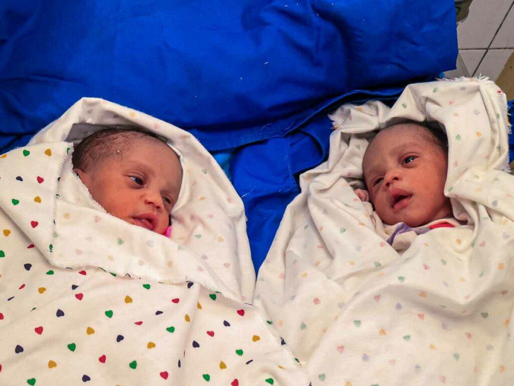 Erfolgreicher Notkaiserschnitt bei Zwillingsschwangerschaft mit Komplikationen